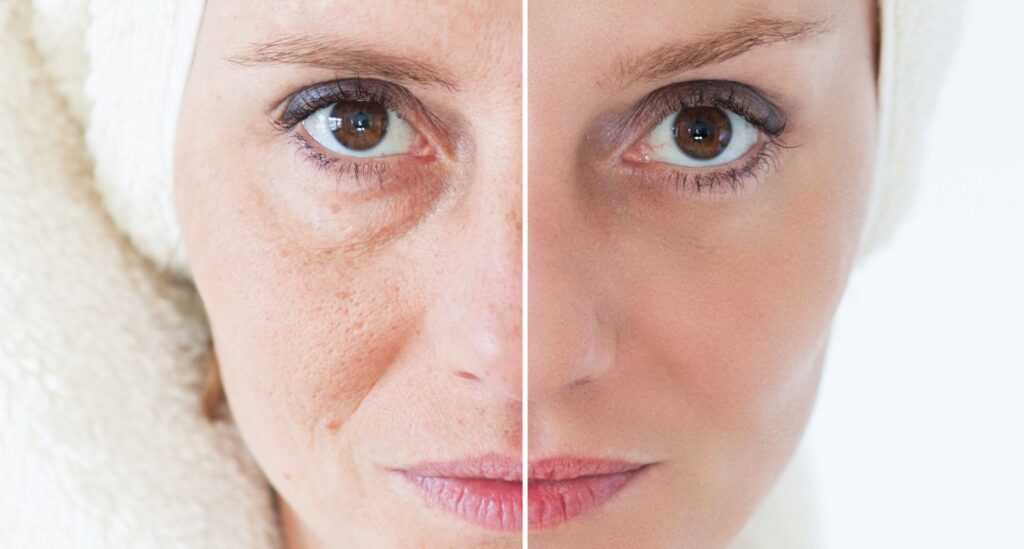 xr:d:DAE1u6A5Ezo:253,j:39591055675,t:22103119