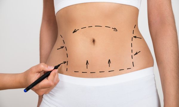 Liposuction & Body Contouring Master Class